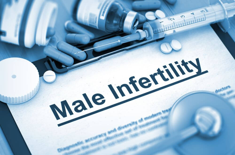 Varicocele embolization — varicocele and male infertility | Prof. Dr. Imtiaz Ahmad, interventional radiologist Pakistan