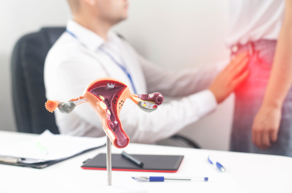 Uterine fibroid embolization (UFE) — bidding goodbye to fibroids and adenomyosis a novel treatment strategy featured image | Prof. Dr. Imtiaz Ahmad, interv