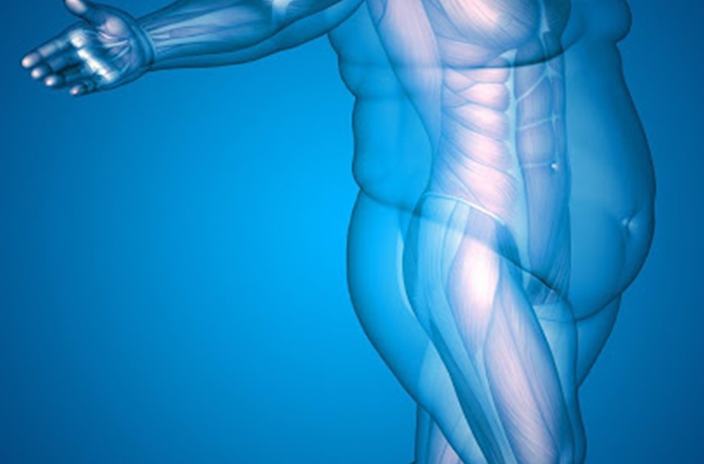 Bariatric arterial embolization — a trouble free obesity treatment nanoblock bariatricarterial embolization featured image | Prof. Dr. Imtiaz Ahmad, interv