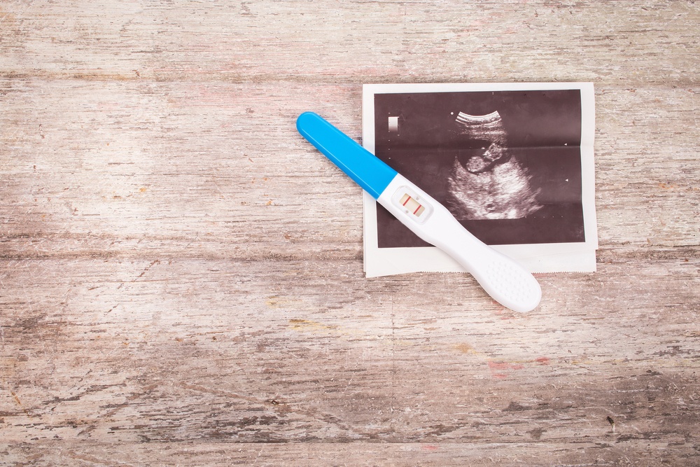 Uterine fibroid embolization (UFE) — how does uterine fibroid affect pregnancy image one | Prof. Dr. Imtiaz Ahmad, interventional radiologist Pakistan