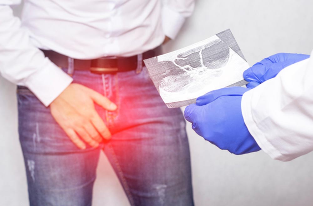 Varicocele embolization — non surgical solutions for varicocele treatment featured image | Prof. Dr. Imtiaz Ahmad, interventional radiologist Pakistan