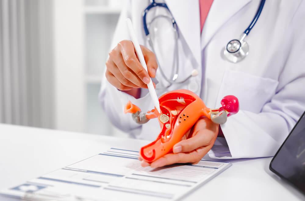 Uterine fibroid embolization (UFE) — non surgical uterus fibroid treatment proven methods featured image | Prof. Dr. Imtiaz Ahmad, interventional radiologi