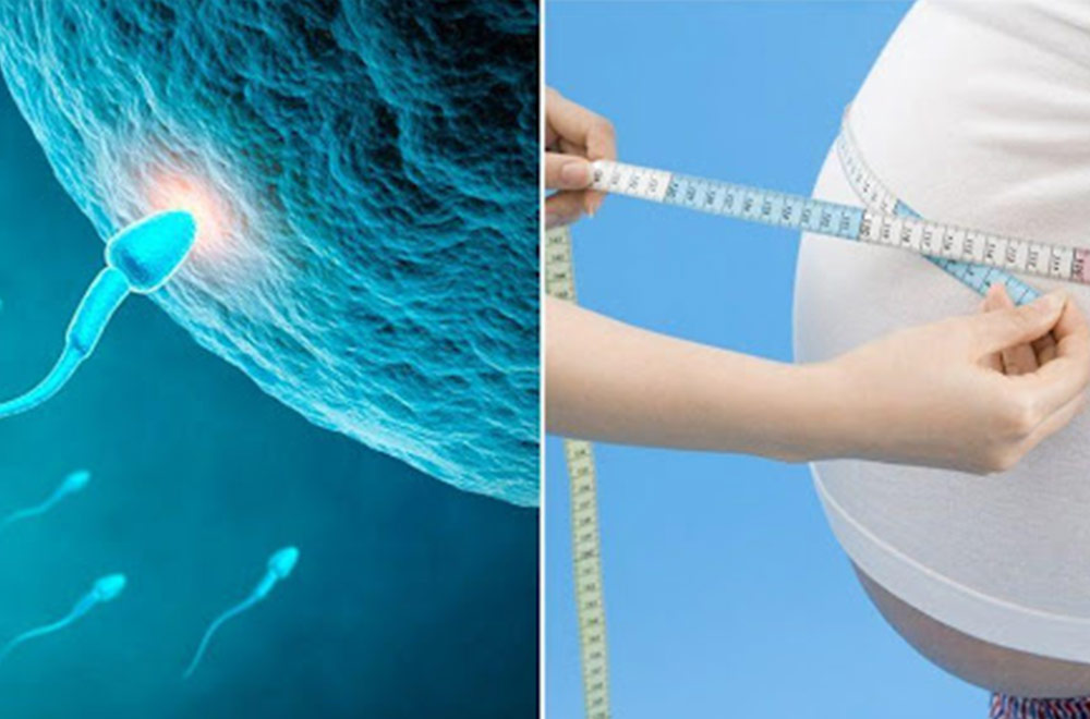 Bariatric arterial embolization — obesity and infertility are they linked featured image | Prof. Dr. Imtiaz Ahmad, interventional radiologist Pakistan
